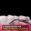 Electric Dental Calculus Remover - Mystery Gadgets electric-dental-calculus-remover, Gadget
