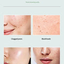 Green Tea Blackhead Remover Mask - Mystery Gadgets green-tea-blackhead-remover-mask, Beauty Accessories